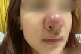 “猪鼻子”照片全网可见！接受整容的女孩被网友人身攻击……图片