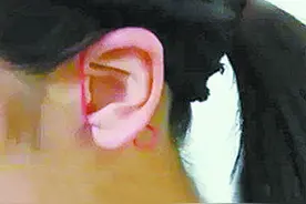 橡皮筋绑耳朵、毛巾垫腰腹、保鲜膜裹全身 这些奇葩减肥法有用吗？医生分析提醒图片