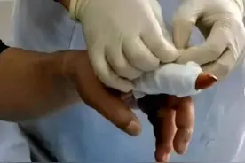 医生敲警钟！这里“小伤”莫大意，当心导致功能丧失图片