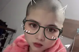 遂宁90后“光头护士”与化疗脱发患者比“美”图片