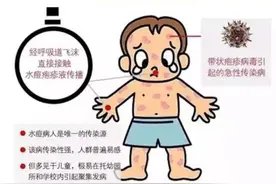 认识水痘，一起“战痘”图片