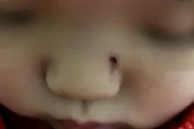 孩子送到早教班，鼻子被老师指甲戳伤，家长崩溃：这是半年内第6次受伤了图片