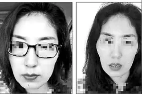 徒手整骨调查：号称不开刀就能瘦脸，是不是忽悠？图片