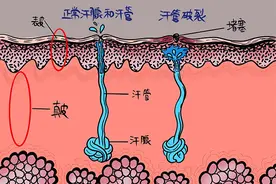你不知道的人体小秘密——汗腺图片