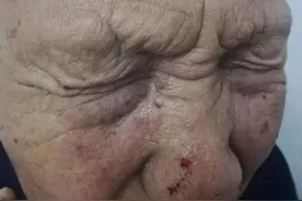 男子曝光邻居上门打伤老人 拒绝警方删帖要求后被拘留又丢工作图片