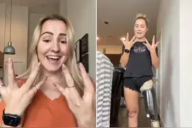 23岁女孩患怪病只有8根手指 乐观生活走红网络图片