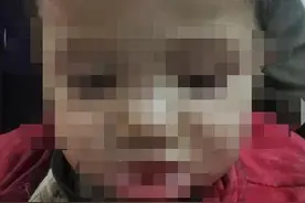 宁夏5岁女童嘴被严重灼伤，这些东西要放好图片