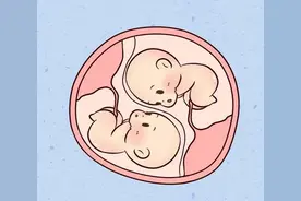 凶险！杭州一姑娘临产，一胎在子宫里，另一胎竟在……图片