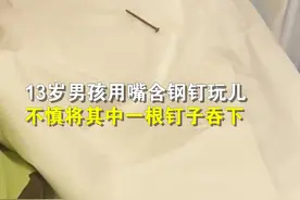 13岁男孩误吞4厘米钢钉 医生十分钟取出图片