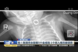 南方都市报：险！刚满月女婴戴5个金戒指  1个掉入嘴巴被误吞