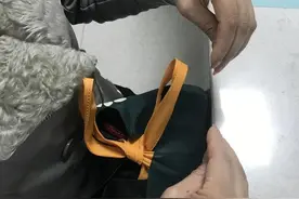 杭州女子跟丈夫吵架后，双手痉挛如鸡爪！医生：这是“气到中毒了”图片