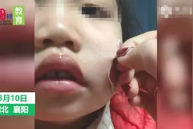 表现好被幼儿园老师贴贴纸奖励，女儿回到家妈妈却发现悲剧了图片