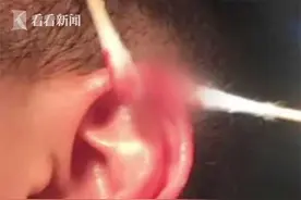 男子理发剪伤耳朵，店家竟称不介意“以肉偿肉”图片