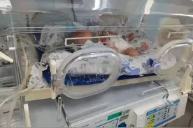 医生连环电话急CALL孕妇，胎儿在娘胎里差点肠坏死图片