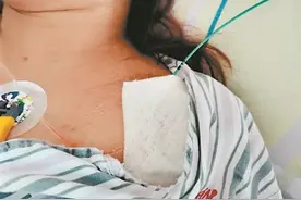 顺德医生施术救“孕妈”图片