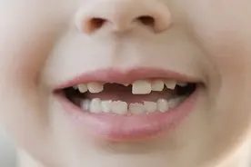 儿童乳牙脱落后，多久能长出恒牙？