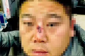 争挖掘机技术谁更强，男子一记勾拳把老乡鼻梁打至粉碎性骨折图片