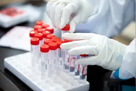 热景生物暴涨、之江生物业绩增17倍，核酸检测概念股怎样了？图片