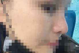 来南宁求美却把鼻子整歪了，三女子维权时发现医院已更名图片