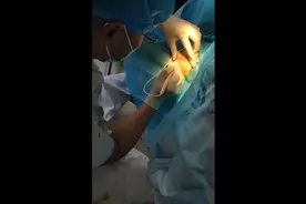 娄底：26岁女孩被腋臭困扰13年 医生支招1小时远离它图片