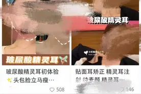 网红鼓吹“精灵耳”等自残式整容，容貌内卷何以至此图片