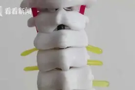 吊脖子健身走红 医生提醒：小心瘫痪图片