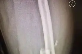 海口世纪大桥车祸肇事者家属与伤者家属见面，最新进展来了图片