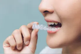 隐形牙套，看上去挺美图片