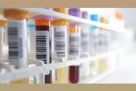 采血后“按压”多久为宜