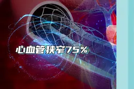 冠心病患者心血管狭窄达75%就要放支架，是真的吗？心脏内科专家解答→图片