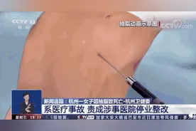 别轻易尝试！女子抽脂后去世，医生提醒→图片