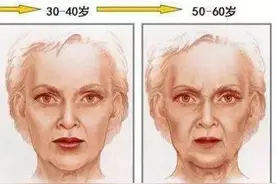 济南海峡整形分享：吸脂后皮肤会变松弛吗？图片