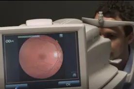 AI眼病筛查能力已超眼科医生？专家称软件仍有提升空间图片