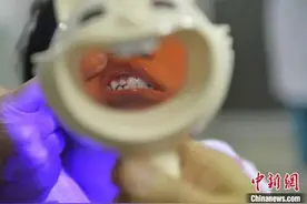 疯狂的牙套：“9块9包邮”就能实现整牙自由？图片