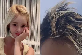 韩女星漂发失败「手一碰就断」45%头发没了 崩溃诉：像90岁奶奶图片