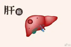 面色发黑，警惕肝癌图片