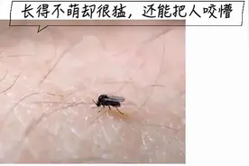 惊呆了！女子公园野餐后，小腿上布满密密麻麻的……最近户外多发图片