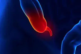 长期右下腹痛，不都是阑尾炎图片