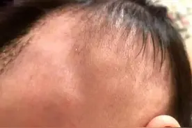 太可怜了！刚出生6天被摔成头骨骨折、颅内出血……图片