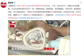 现实版“香妃”？新生儿全身散发甜甜的香味，洗也洗不掉！竟然是一种病…图片