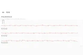 把你的心交给它吧！OPPO Watch 2 ECG版上手体验图片