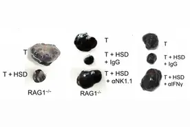 《科学》子刊：高盐饮食能抗癌？科学家发现，高盐饮食会改变小鼠肠道通透性和双歧杆菌丰度，调节NK细胞活性，抑制肿瘤生长丨科学大发现图片