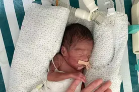 孕24周体重仅一斤的龙凤姐弟“闯关”100天顺利出院图片