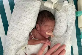 孕24周体重仅一斤的龙凤姐弟“闯关”100天顺利出院图片