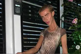 网红减肥瘦到「骨头清楚现形」四肢细如竹竿！对比照曝…网全吓坏图片