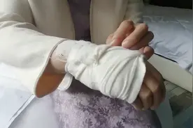 淋浴室玻璃门突然碎了，女子入住酒店全身被多处划伤图片