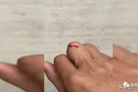 游客动植物园内被“散装蛇”咬伤，一周之后蛇仍未找到...图片