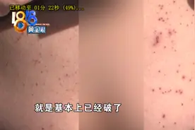 男子体验分娩阵痛，到6级后肚皮受伤！​小两口质疑仪器存在问题图片