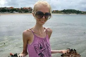 世界上最瘦的三个女人，还喜欢瘦女孩吗？图片