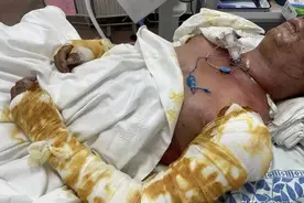 外卖小哥睡梦中，正充电的电单车电池突然爆燃！图片